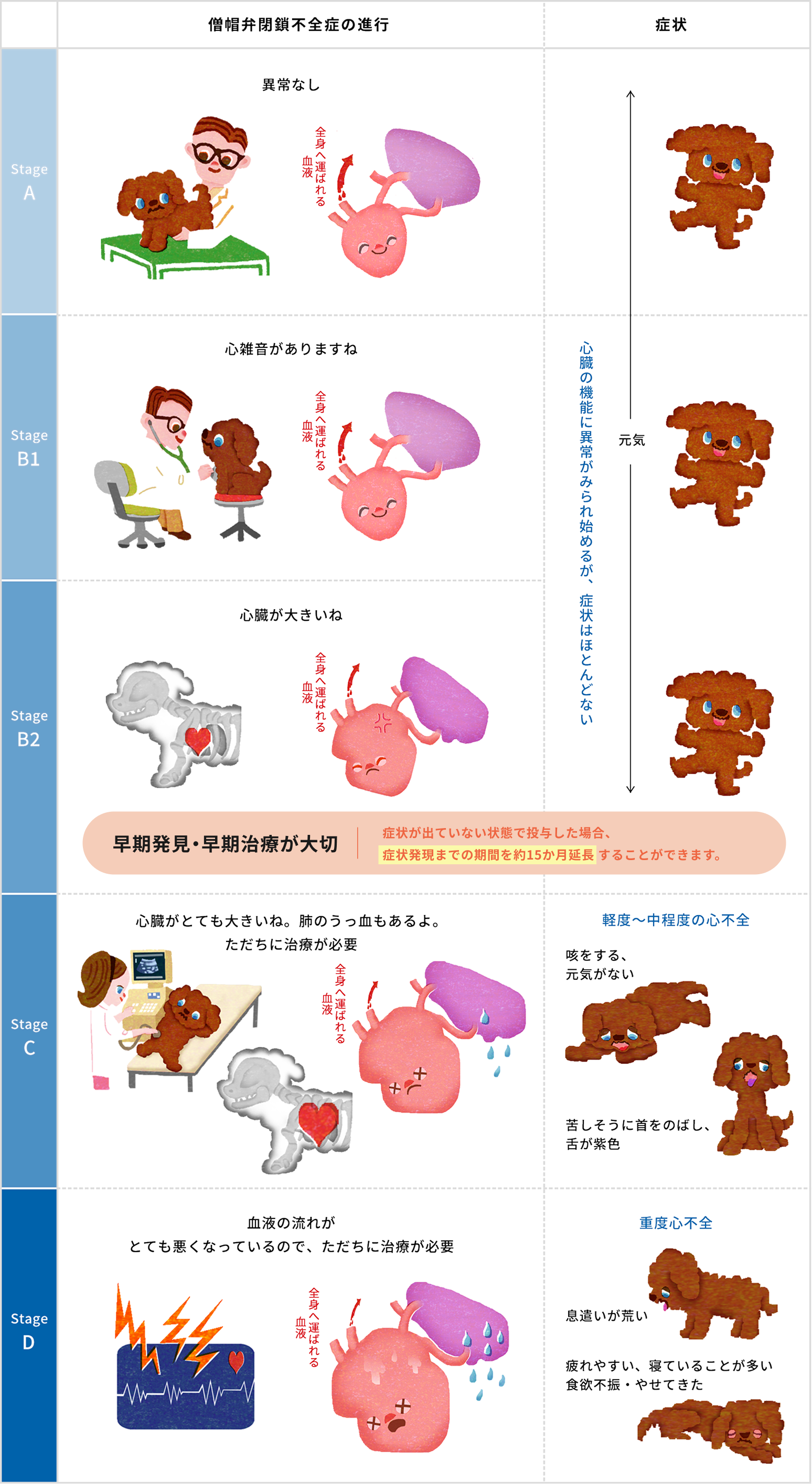 僧帽弁閉鎖不全症の進行