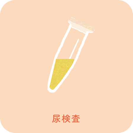 尿検査