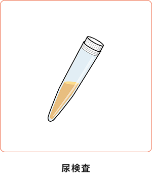尿検査