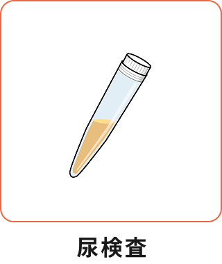 尿検査