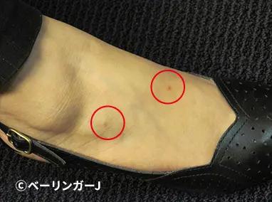 ノミ刺咬症_犬猫のノミの被害