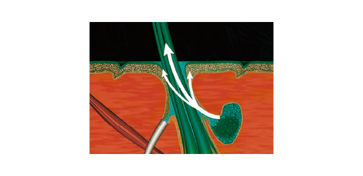 画像:滴下した成分が皮脂腺にたくわえられ、皮脂とともに放出される。